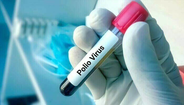 Poliovirus