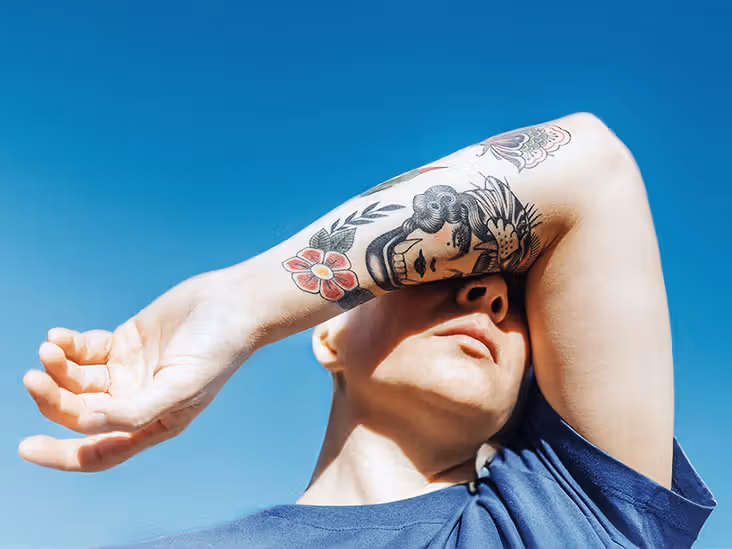 Increased Melanoma Risk