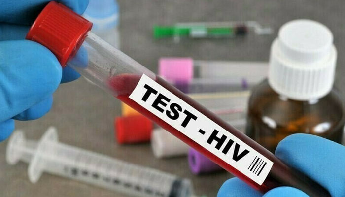 HIV cases in Islamabad