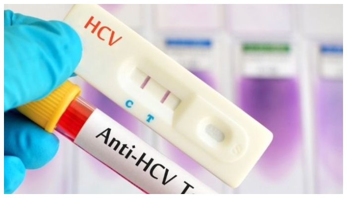 پاکستان میں ہیپاٹائٹس سی کے کیسز میں خطرناک اضافہ