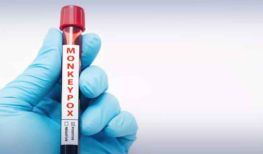 monkeypox case Karachi