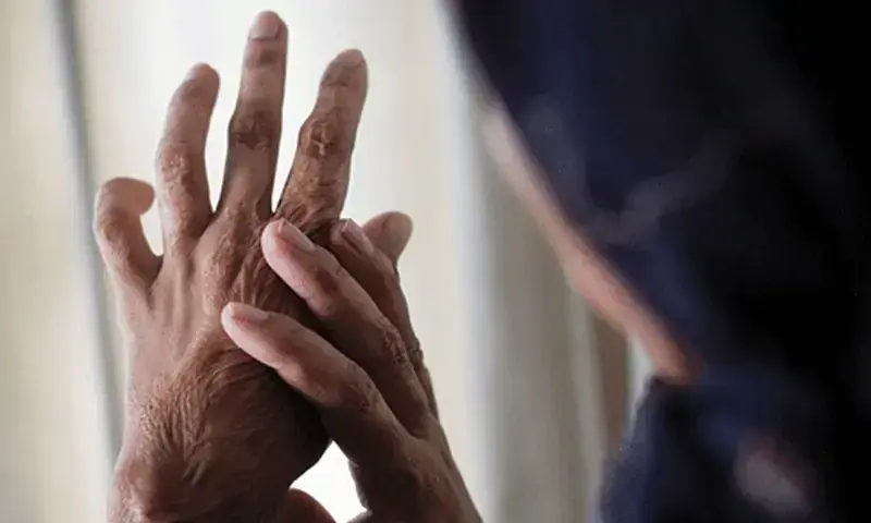Dr Mahnoor Nasar treatment abroad