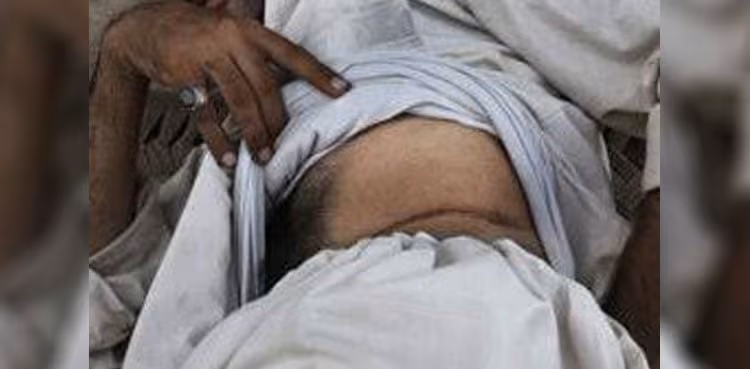illegal kidney transplant network Punjab